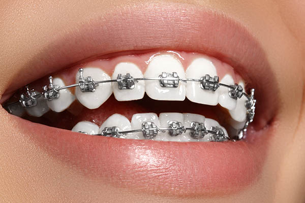 How has Orthodontics Changed in the Last 20 Years?